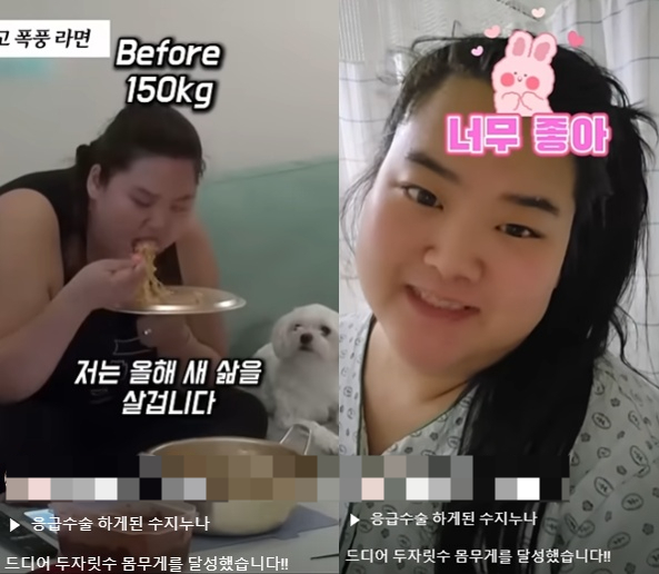 미나 시누이 박수지, 150kg→99kg 감량 후 탈장 수술 성공… "새 삶 시작"