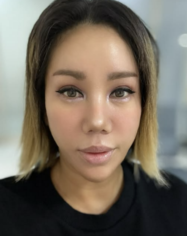 김송, 공동구매 제품 배송 오류에 전액 환불 결단… "남편 강원래의 심각한 욕창 고백까지 안타까운 겹악재"